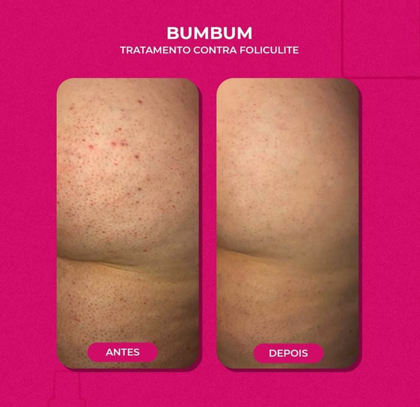 Rosa Selvagem- Huile